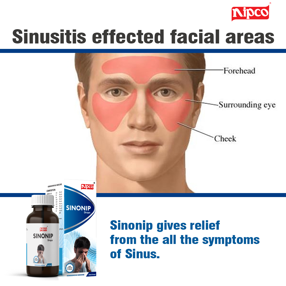 Sinonip – Sinusitis drops (30ml) | Nipco Homeopathic Products