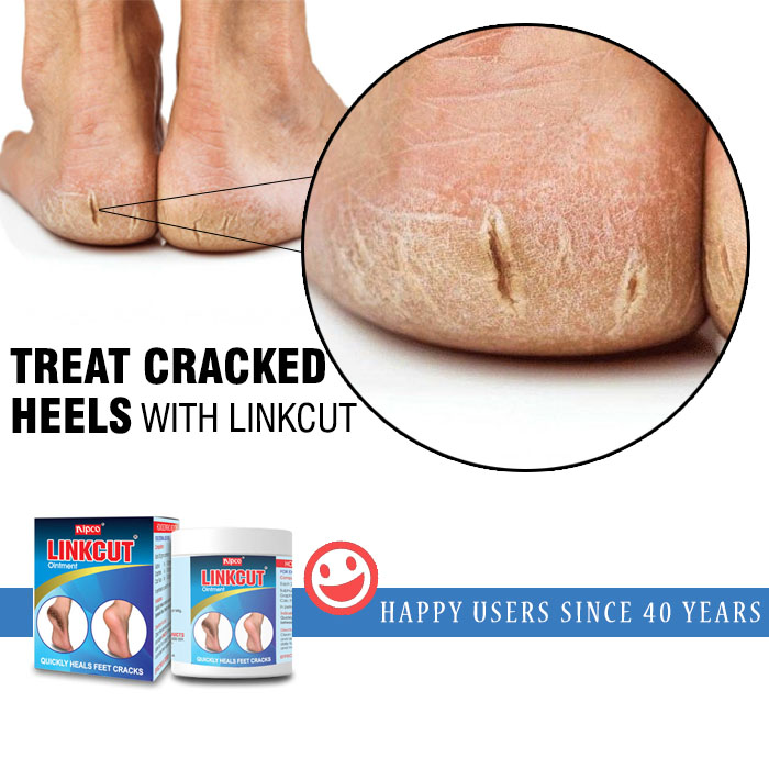 Homeopathic medicine for cracked on sale heels